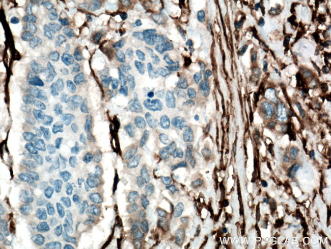 CD90 Antibody in Immunohistochemistry (Paraffin) (IHC (P))