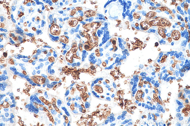 Glycophorin A Antibody in Immunohistochemistry (Paraffin) (IHC (P))
