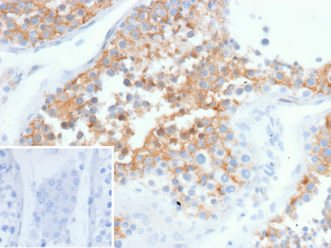SPARC/Osteonectin (O-Nectin) Antibody in Immunohistochemistry (Paraffin) (IHC (P))