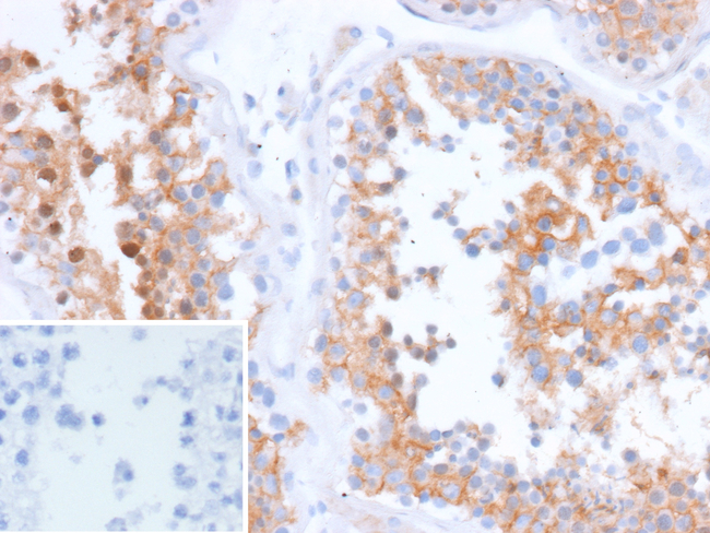 SPARC/Osteonectin/O-Nectin Antibody in Immunohistochemistry (Paraffin) (IHC (P))