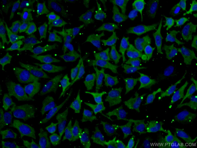 HSPA1L Antibody in Immunocytochemistry (ICC/IF)