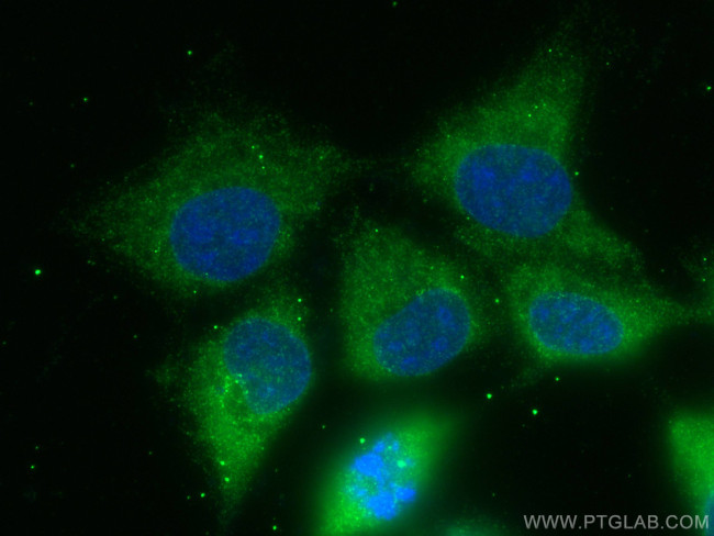 FNTB Antibody in Immunocytochemistry (ICC/IF)