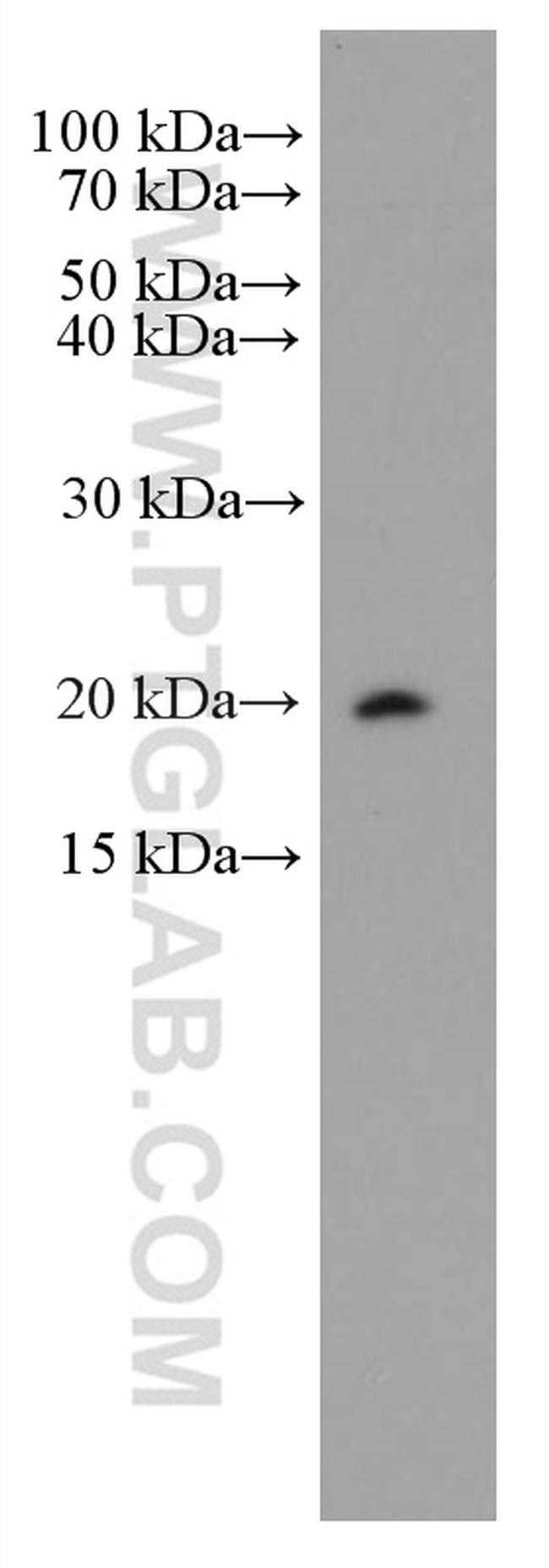 CD52 Antibody in Western Blot (WB)