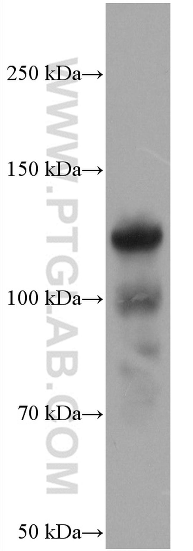 COMP Antibody in Western Blot (WB)