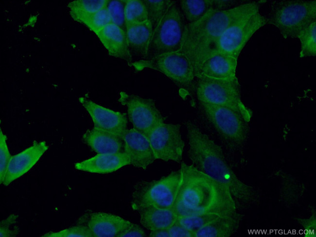 PTPN11 Antibody in Immunocytochemistry (ICC/IF)