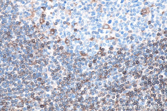 HLA-F Antibody in Immunohistochemistry (Paraffin) (IHC (P))