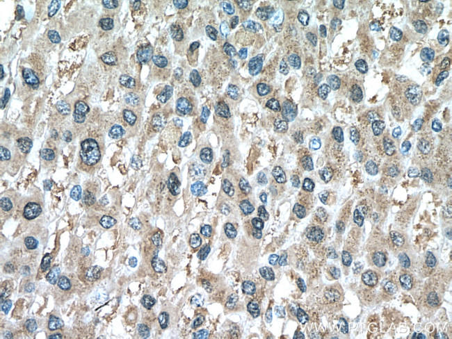 PRDX1 Antibody in Immunohistochemistry (Paraffin) (IHC (P))