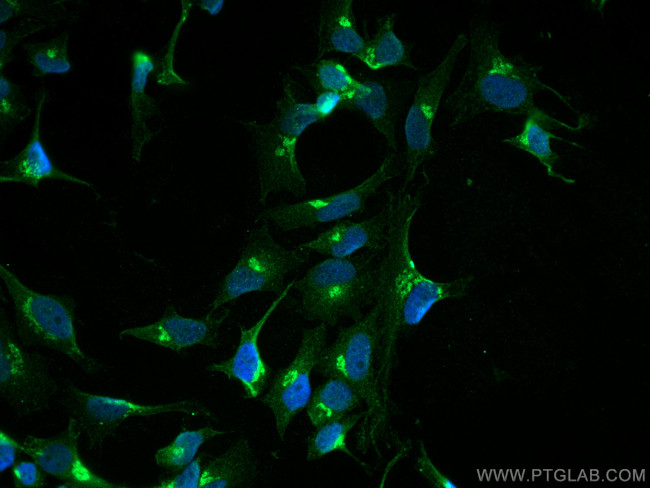 Syntaxin 10 Antibody in Immunocytochemistry (ICC/IF)