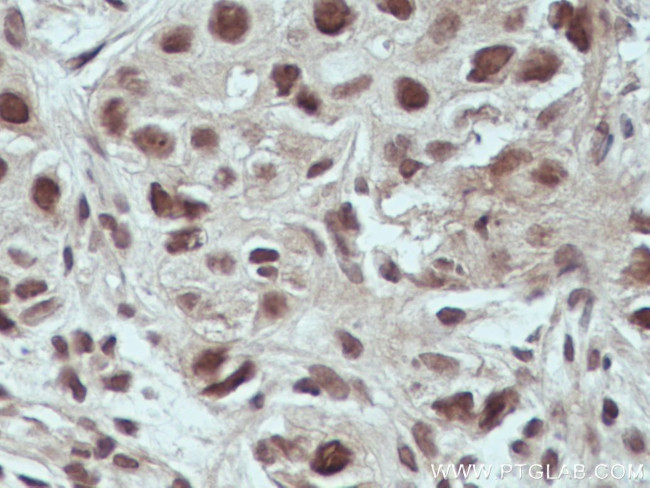 USP4 Antibody in Immunohistochemistry (Paraffin) (IHC (P))