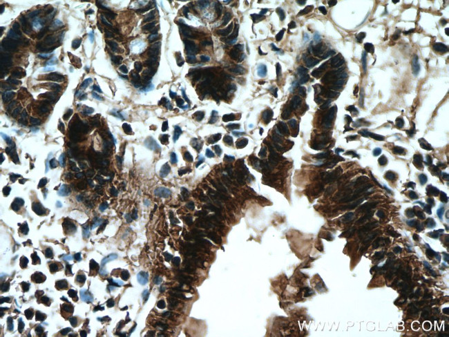 MYH14 Antibody in Immunohistochemistry (Paraffin) (IHC (P))