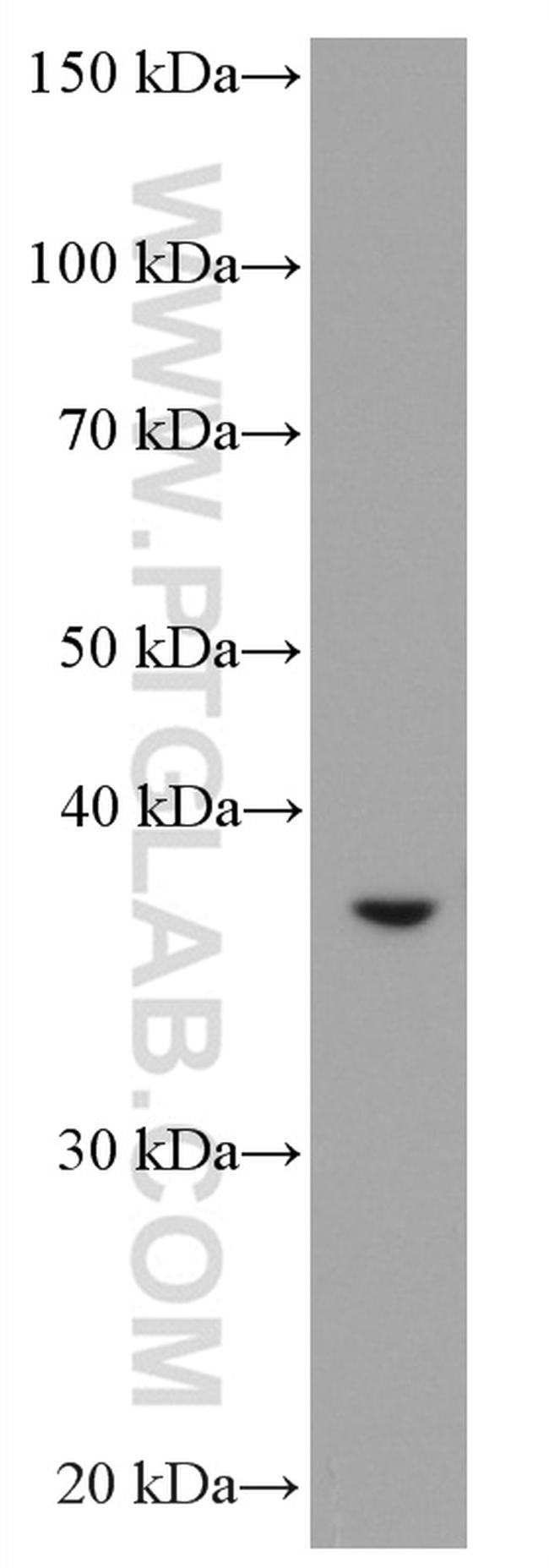 ASGR2 Antibody in Western Blot (WB)
