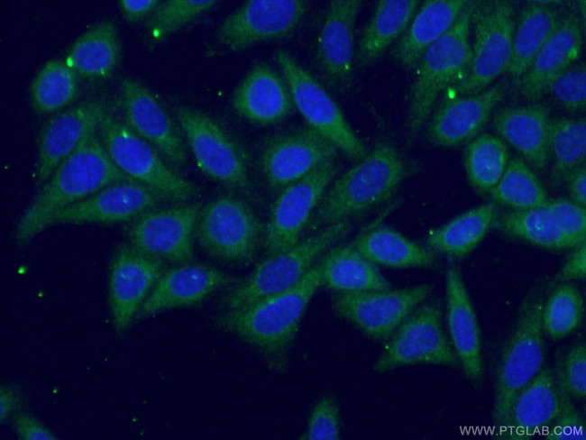 TDRKH Antibody in Immunocytochemistry (ICC/IF)