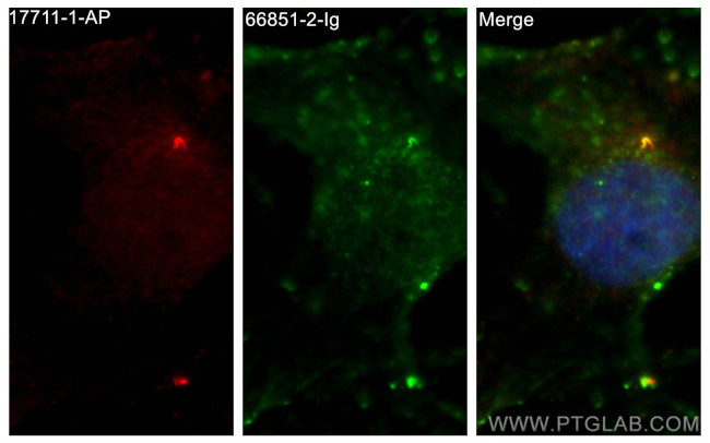 SMO Antibody in Immunocytochemistry (ICC/IF)