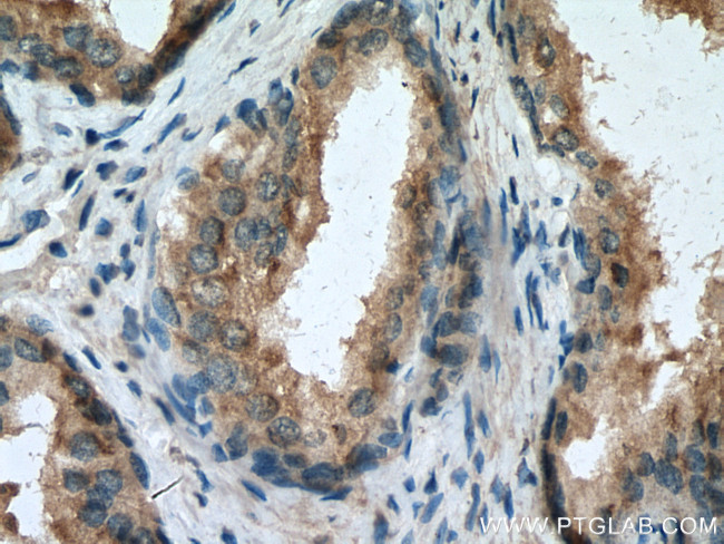 SPON2 Antibody in Immunohistochemistry (Paraffin) (IHC (P))