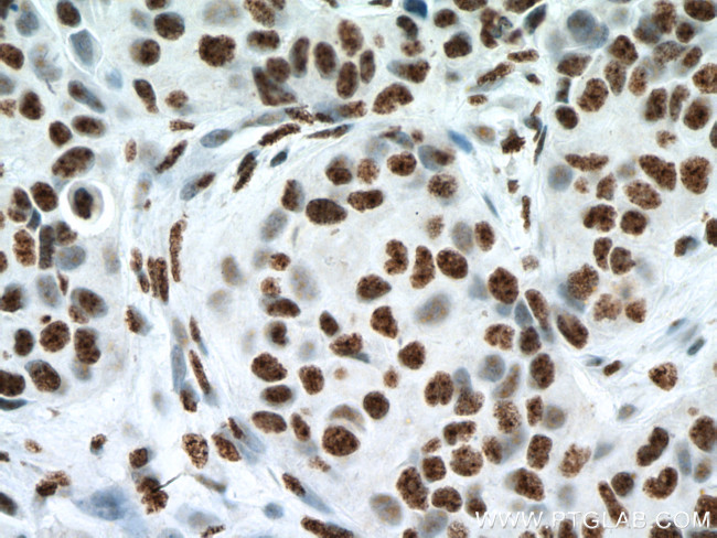 Phospho-Histone H3 (Ser10) Antibody in Immunohistochemistry (Paraffin) (IHC (P))