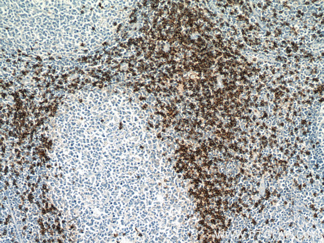 CD8 Antibody in Immunohistochemistry (Paraffin) (IHC (P))