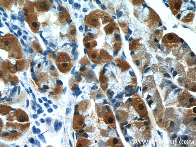 Annexin A10 Antibody in Immunohistochemistry (Paraffin) (IHC (P))