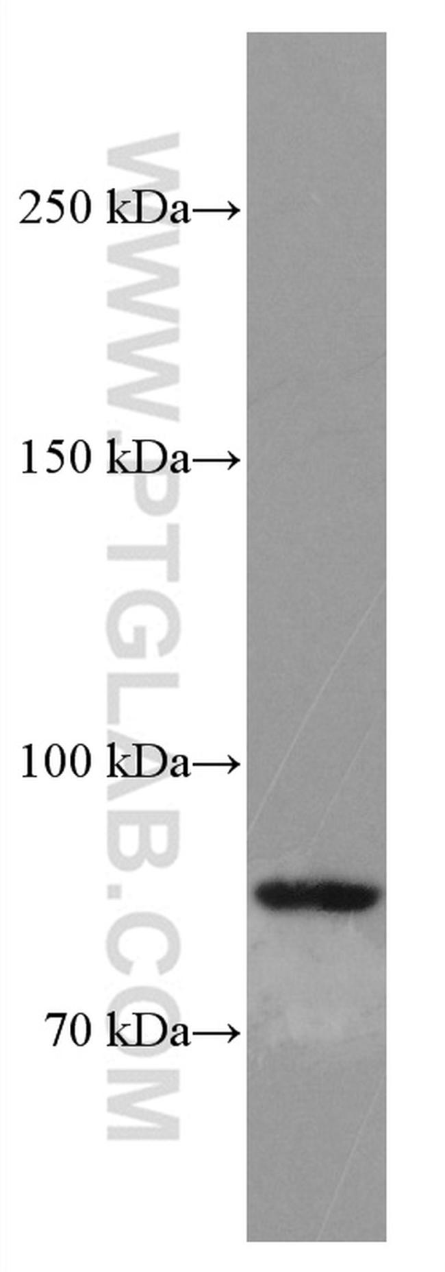 SMYD4 Antibody in Western Blot (WB)