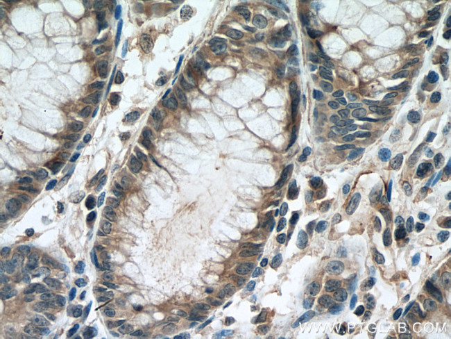 STIL Antibody in Immunohistochemistry (Paraffin) (IHC (P))