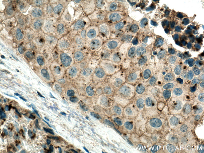 Flotillin 2 Antibody in Immunohistochemistry (Paraffin) (IHC (P))
