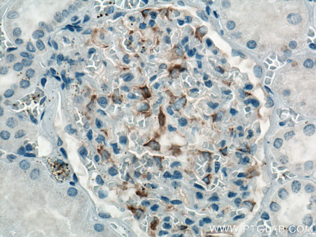 INF2 Antibody in Immunohistochemistry (Paraffin) (IHC (P))