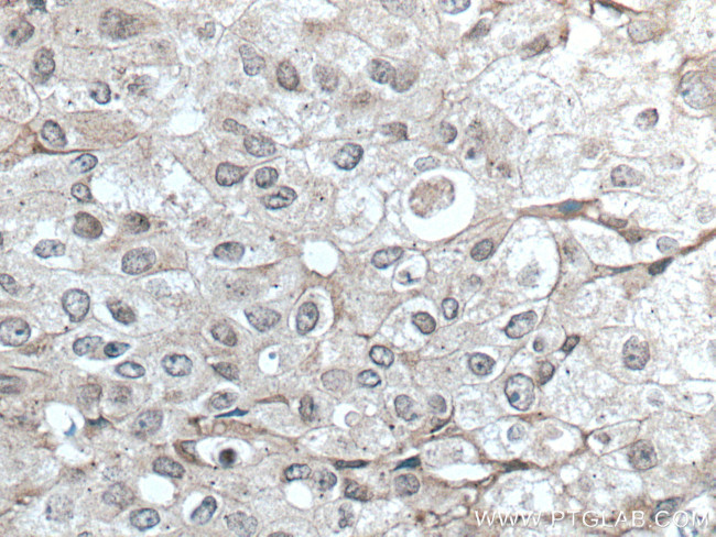 TFG Antibody in Immunohistochemistry (Paraffin) (IHC (P))