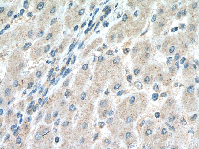 NFKB2 Antibody in Immunohistochemistry (Paraffin) (IHC (P))