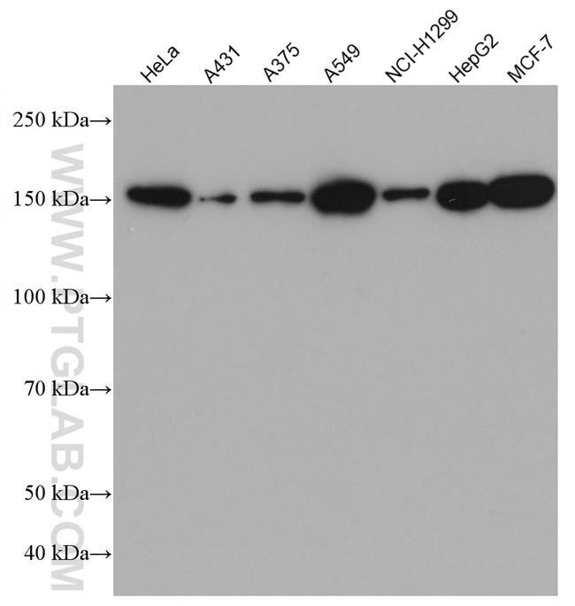 CFTR Antibody in Western Blot (WB)