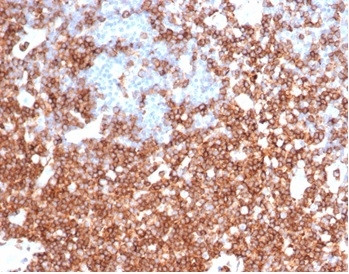 CD43 (T-Cell Marker) Antibody in Immunohistochemistry (Paraffin) (IHC (P))