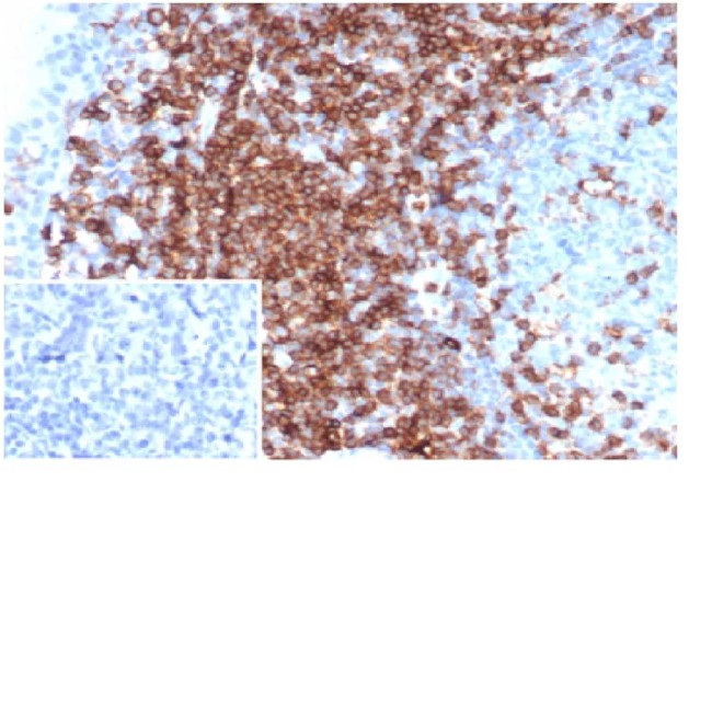 CD43 (T-Cell Marker) Antibody in Immunohistochemistry (Paraffin) (IHC (P))