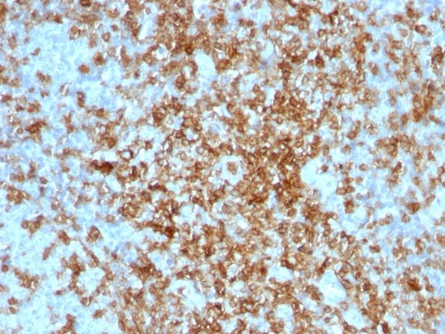 CD43 (T-Cell Marker) Antibody in Immunohistochemistry (Paraffin) (IHC (P))
