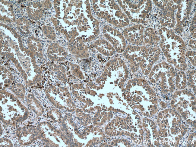 PHEX Antibody in Immunohistochemistry (Paraffin) (IHC (P))