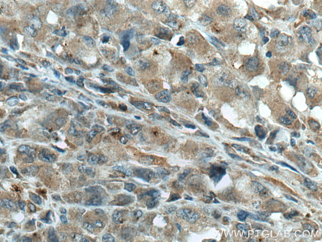 GIMAP5 Antibody in Immunohistochemistry (Paraffin) (IHC (P))