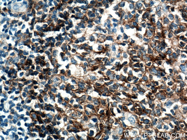 CD40 Antibody in Immunohistochemistry (Paraffin) (IHC (P))