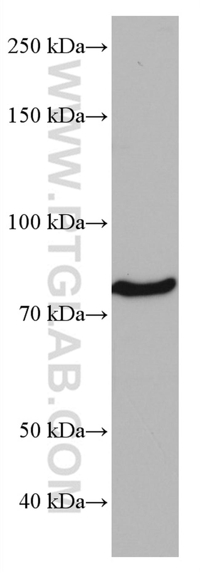 CD97 Antibody in Western Blot (WB)