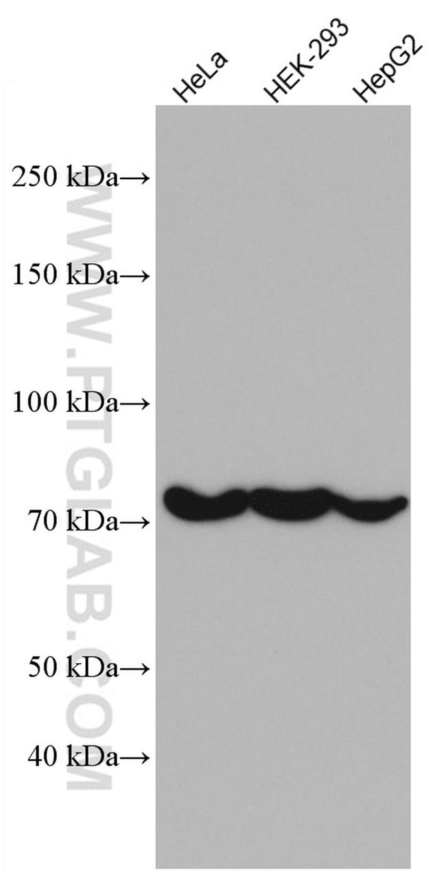 CAPN2 Antibody in Western Blot (WB)