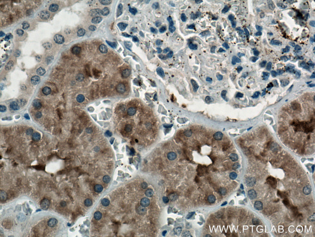 FTCD Antibody in Immunohistochemistry (Paraffin) (IHC (P))