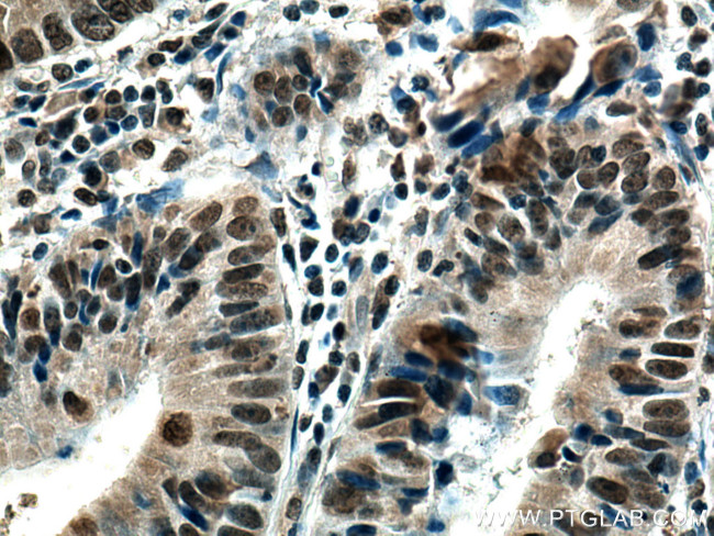 SMC1A Antibody in Immunohistochemistry (Paraffin) (IHC (P))