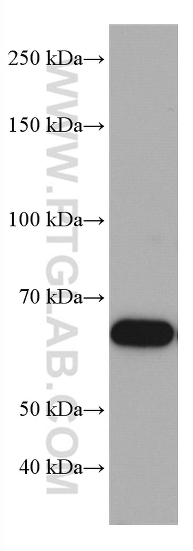 TRAF5 Antibody in Western Blot (WB)