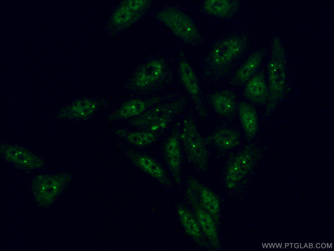 NFKB1 p105/p50 Antibody in Immunocytochemistry (ICC/IF)