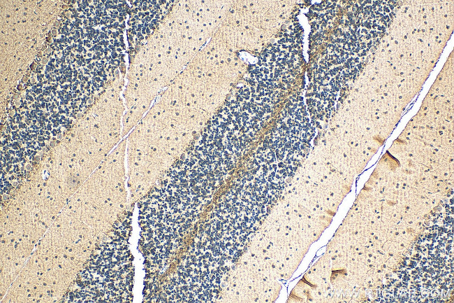 Neuroserpin Antibody in Immunohistochemistry (Paraffin) (IHC (P))