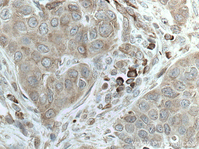 SRP54 Antibody in Immunohistochemistry (Paraffin) (IHC (P))