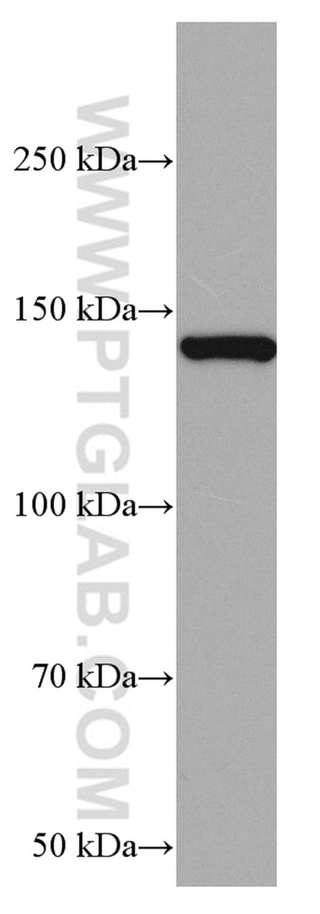 RASGRF1 Antibody in Western Blot (WB)
