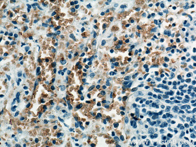 ICAM4 Antibody in Immunohistochemistry (Paraffin) (IHC (P))