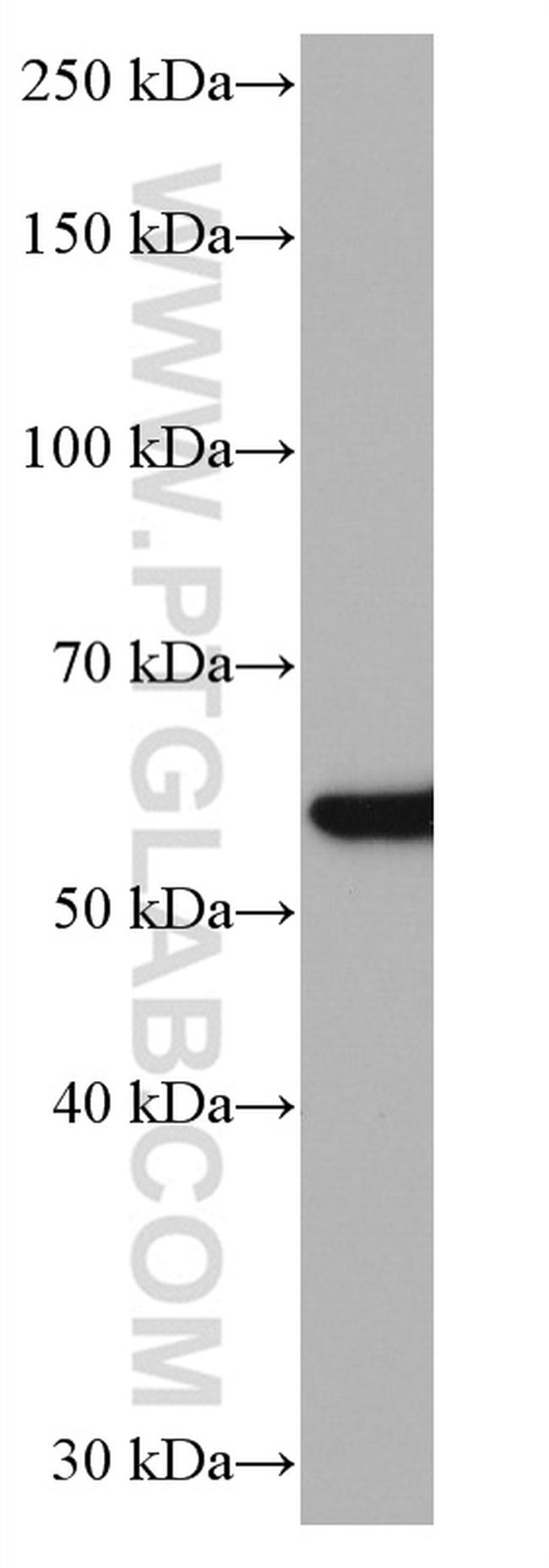 NFS1 Antibody in Western Blot (WB)