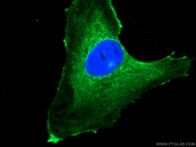 NEU1 Antibody in Immunocytochemistry (ICC/IF)