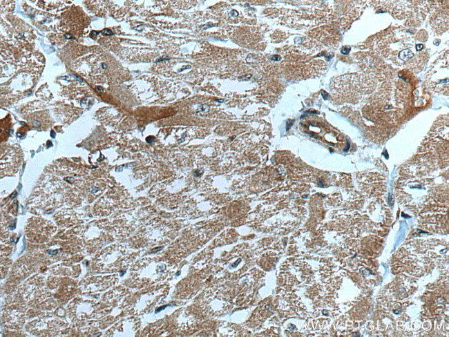 CUL7 Antibody in Immunohistochemistry (Paraffin) (IHC (P))
