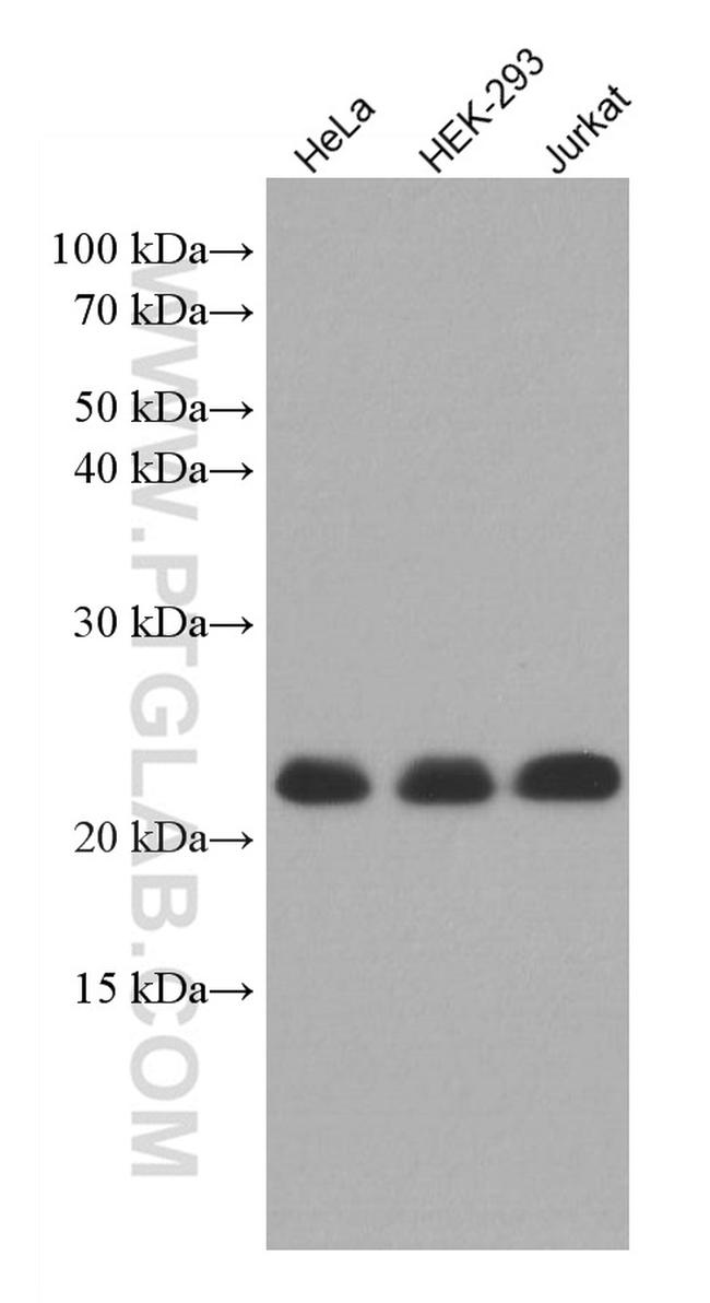 MED30 Antibody in Western Blot (WB)