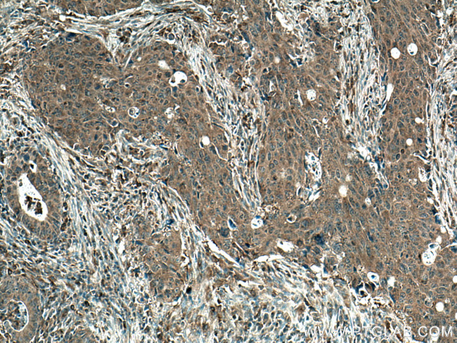 FLII Antibody in Immunohistochemistry (Paraffin) (IHC (P))