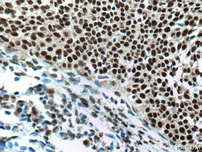 PELP1 Antibody in Immunohistochemistry (Paraffin) (IHC (P))
